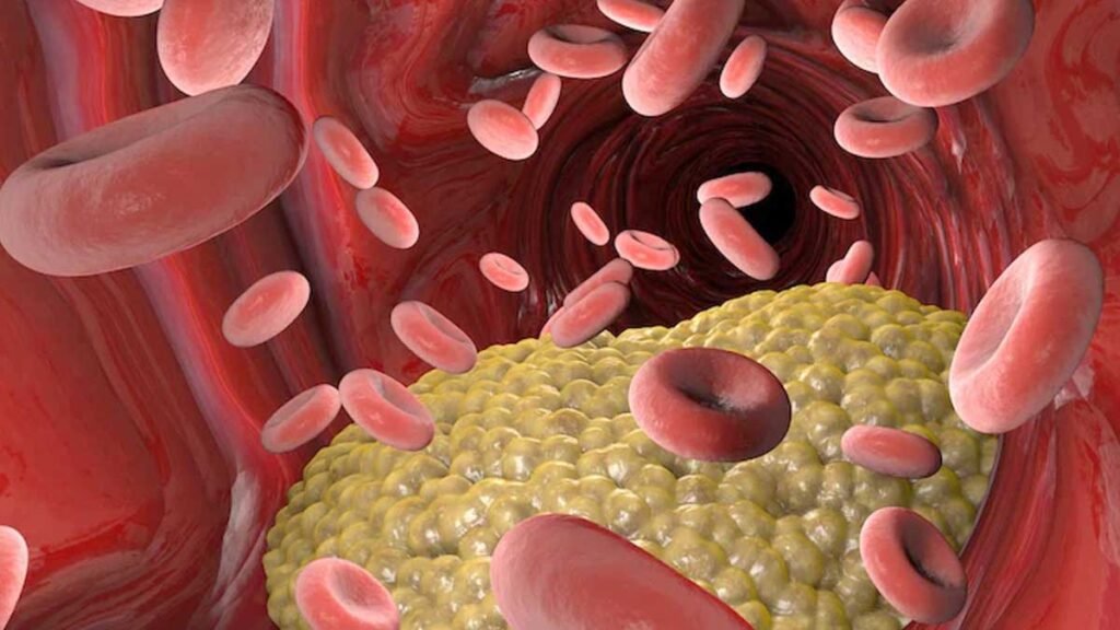 दिल की सेहत के लिए जरूरी है लिपिड प्रोफाइल